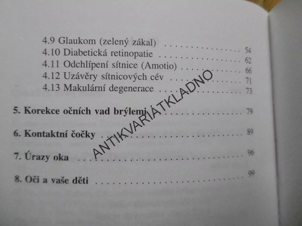 CHRAŇTE SVŮJ ZRAK, ŠÁRKA PITROVÁ, OČI, **an