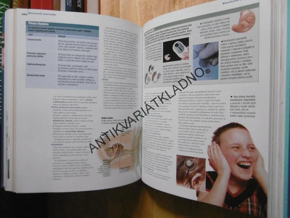 RODINNÁ ENCYKLOPEDIE MEDICÍNY A ZDRAVÍ, **an