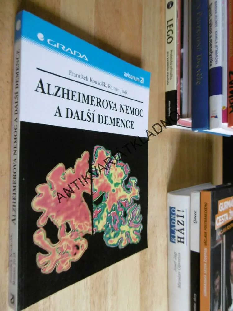 ALZHEIMEROVA NEMOC A DALŠÍ DEMENCE, KOUKOLÍK, JIRÁK