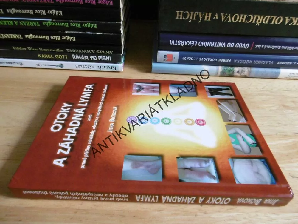 OTOKY A ZÁHADNÁ LYMFA ANEB PRAVÉ PŘÍČINY CELULITIDY, OBEZITY A NEÚSPĚŠNÝCH POKUSŮ ZHUBNOUT, ZDRAVÍ, **an