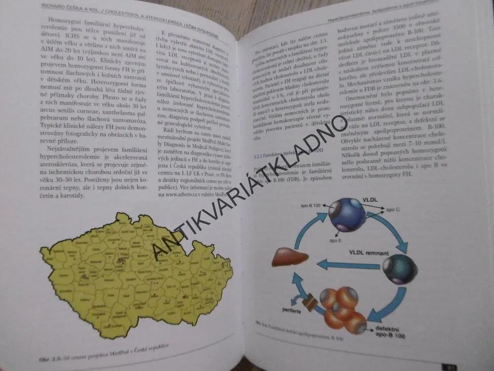 CHOLESTEROL A ATEROSKLERÓZA, LÉČBA DYSLIPIDÉMIÍ, RICHARD ČEŠKA, **an