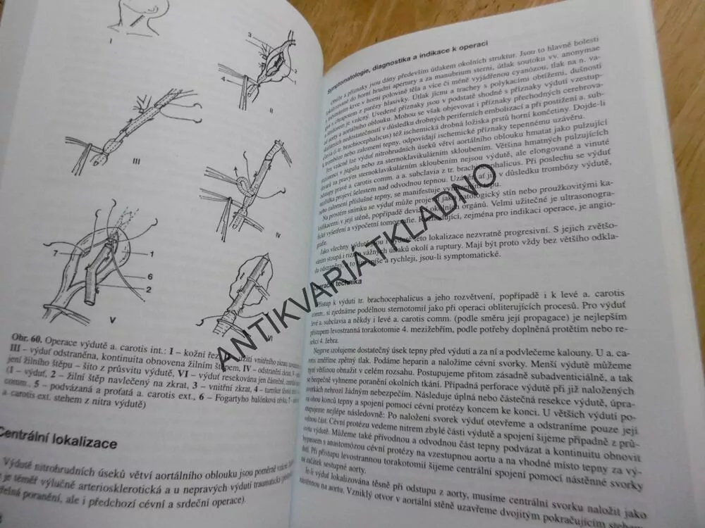 CÉVNÍ CHIRURGIE, FIRT, HEJNAL, VANĚK, UČEBNÍ TEXTY UNIVERSITY KARLOVY PRAHA