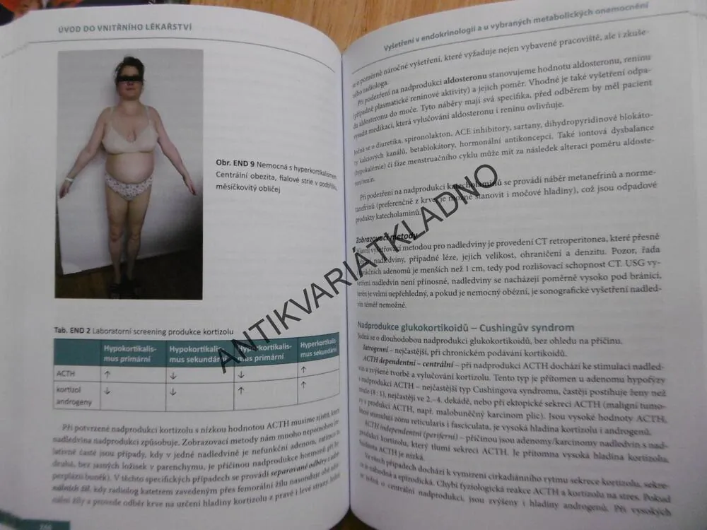 ÚVOD DO VNITŘNÍHO LÉKAŘSTVÍ, JITKA MLÍKOVÁ SEIDLEROVÁ, **an