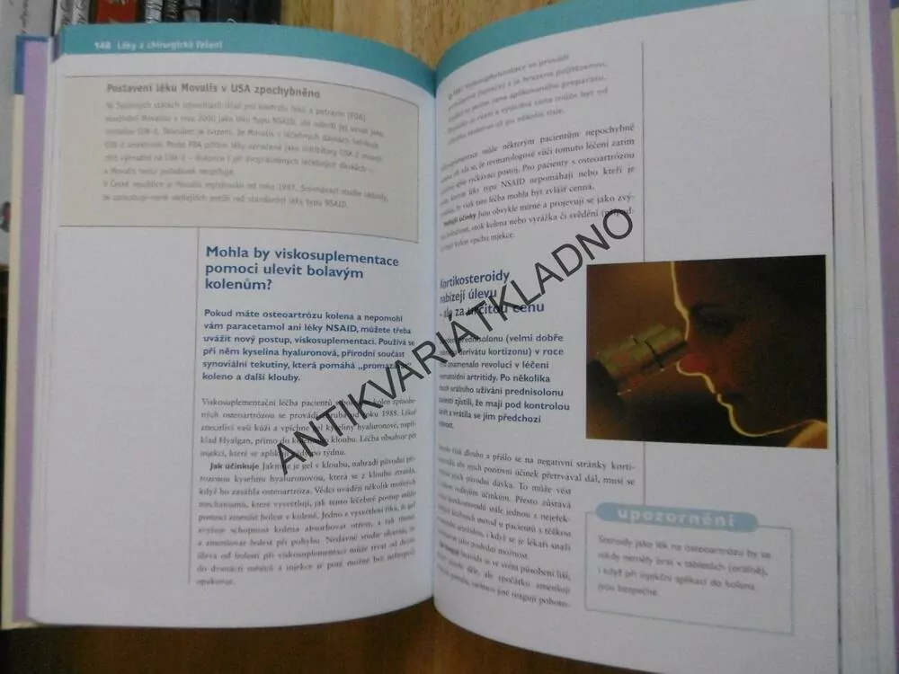 JAK VYZRÁT NA ARTRITIDU,RYCHLÁ CESTA KE ZDRAVÍ  A POHODĚ, **an