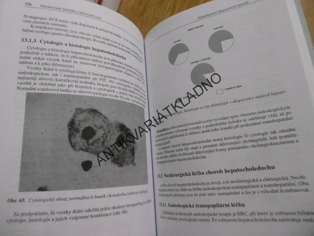 ONEMOCNĚNÍ ŽLUČNÍKU A ŽLUČOVÝCH CEST, MARIE BRODANOVÁ, **an