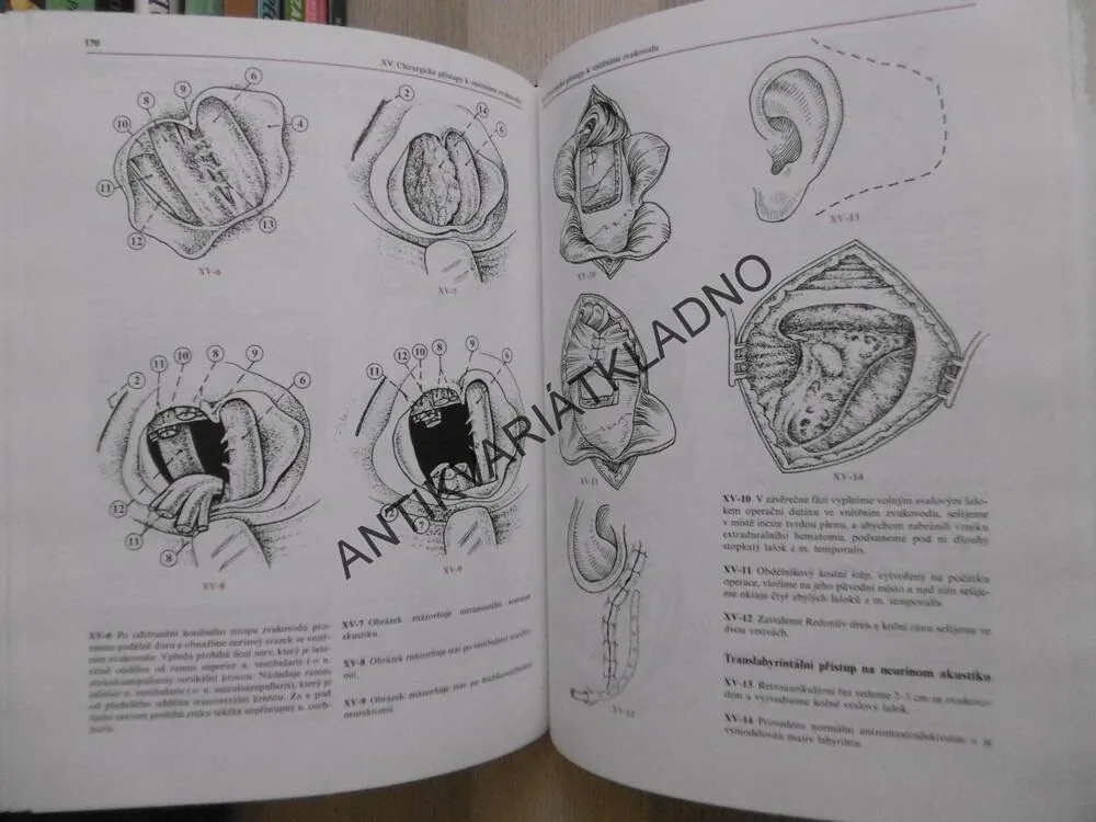 ATLAS CHIRURGIE UCHA, ERVÍN ČERNÝ, JAN BETKA