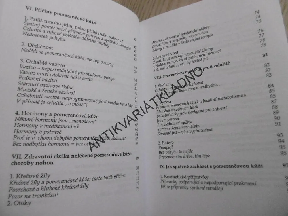 AKTIVNĚ PROTI CELULITIDĚ, RUDOLF WEYERGANS, **an