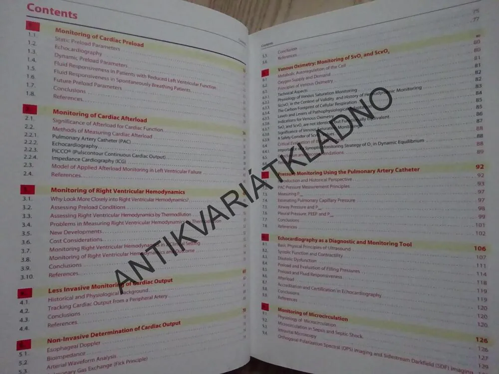 HEMODYNAMIC MONITORING, JOACHIM BOLDT, ANGLICKY, **an