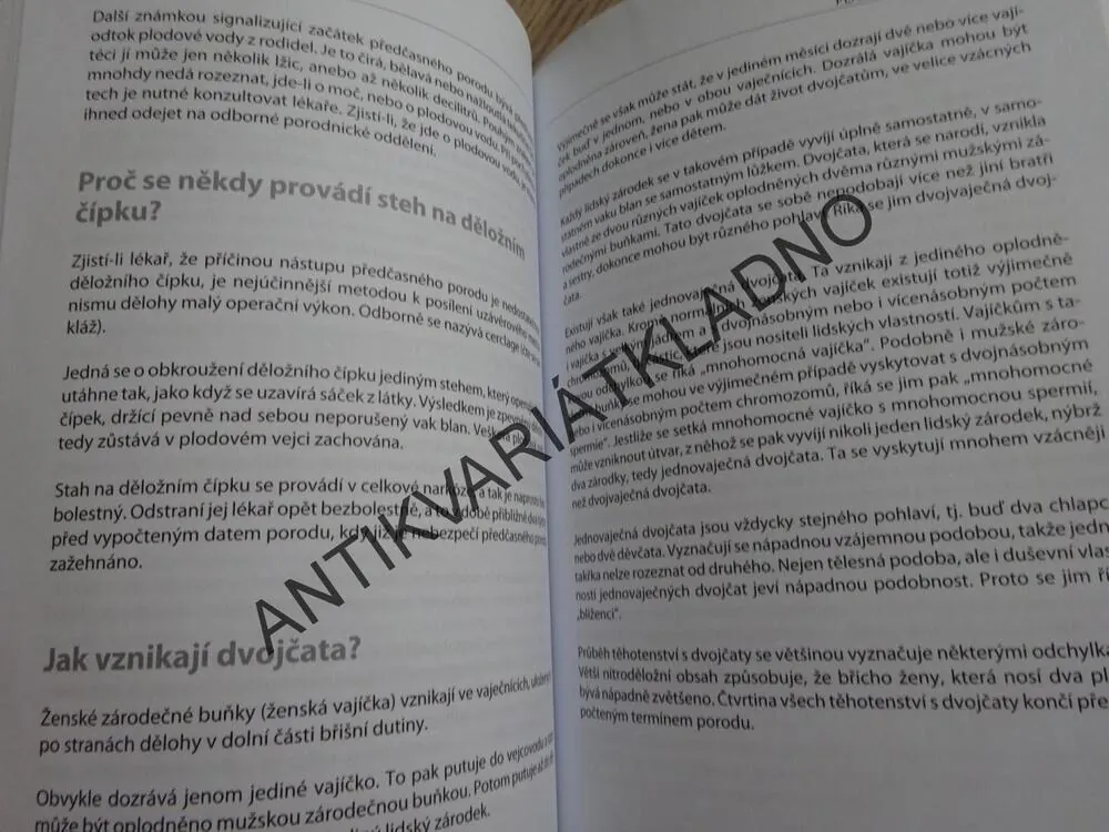 PLÁNOVANÉ RODIČOVSTVÍ, NEJLEPŠÍ CESTA K NAROZENÍ ZDRAVÉHO DÍTĚTE, STANISLAV TRČA, **an