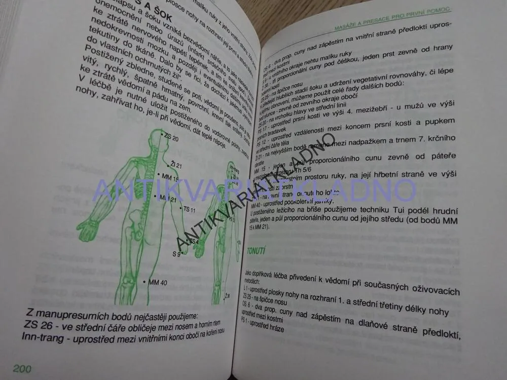 MANUPRESURA, AKUPUNKTURA BEZ JEHEL, RADOMÍR RŮŽIČKA, **an