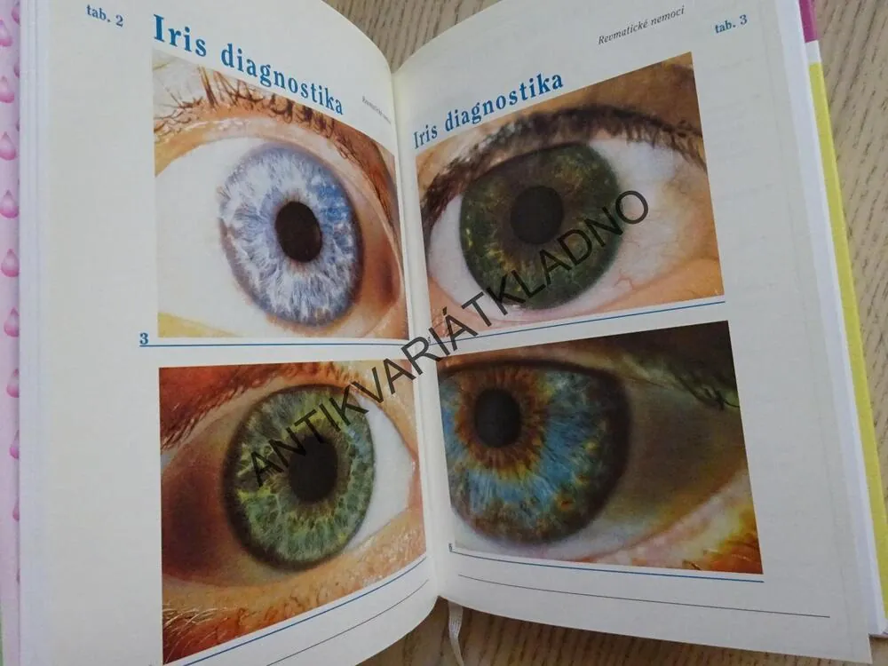 REVMATICKÉ NEMOCI, PŘÍRODNÍ LÉČENÍ, MUDr. JOSEF JONÁŠ, **an