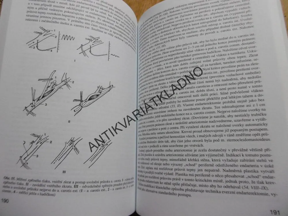 CÉVNÍ CHIRURGIE, FIRT, HEJNAL, VANĚK, UČEBNÍ TEXTY UNIVERSITY KARLOVY PRAHA