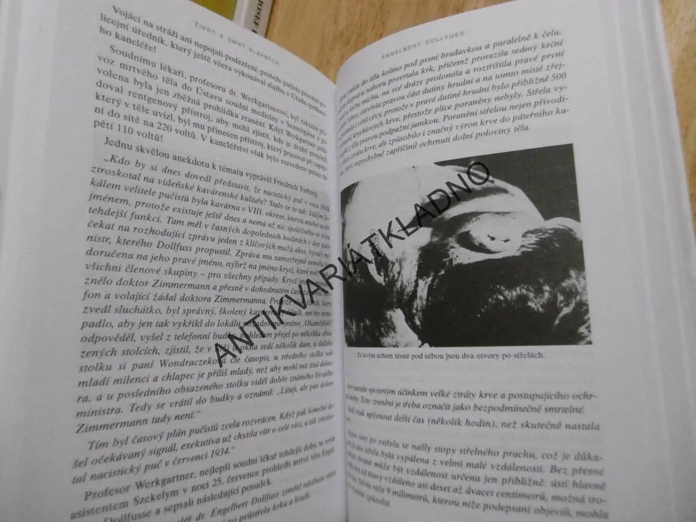 ŽIVOT A SMRT SLAVNÝCH, HANS BANKL, **an
