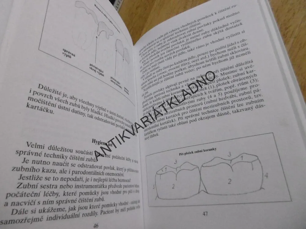 PARADONTOZU LZE LÉČIT, FRANZ STEINWANDTNER, **an