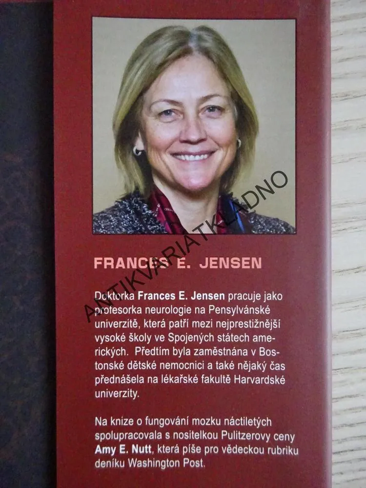 MOZEK TEENAGERA, FRANCES E. JENSEN, AMY ELLIS NUTT, **an