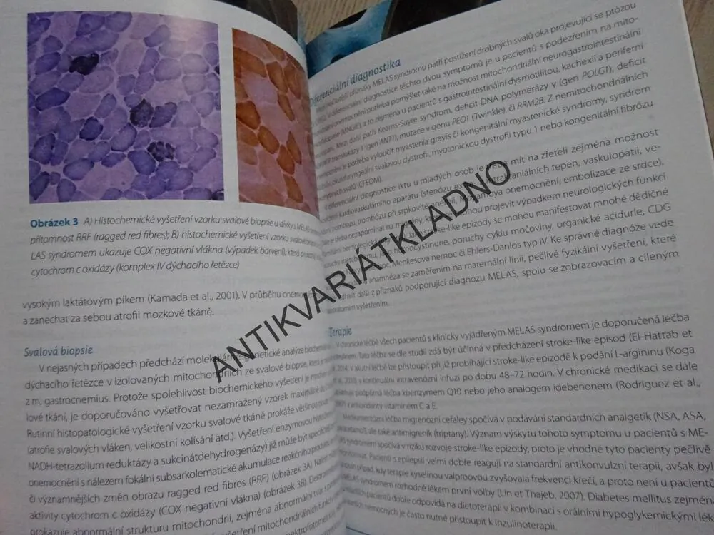 VZÁCNÁ ONEMOCNĚNÍ 2, EHLER A KOLEKTIV, **an