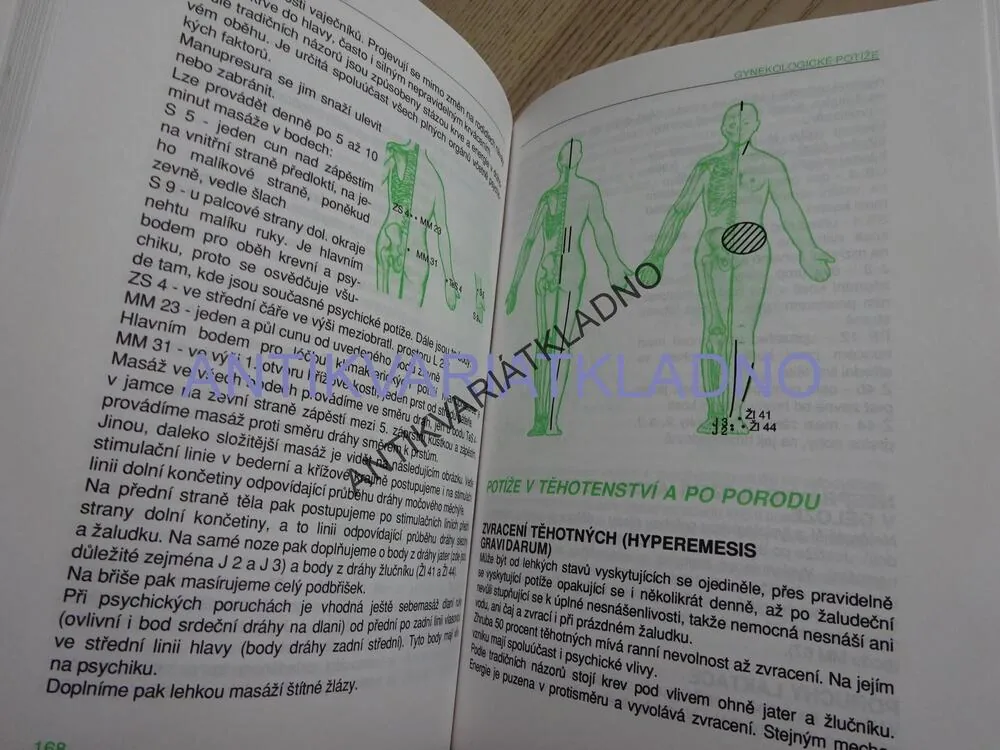 MANUPRESURA, AKUPUNKTURA BEZ JEHEL, RADOMÍR RŮŽIČKA, **an