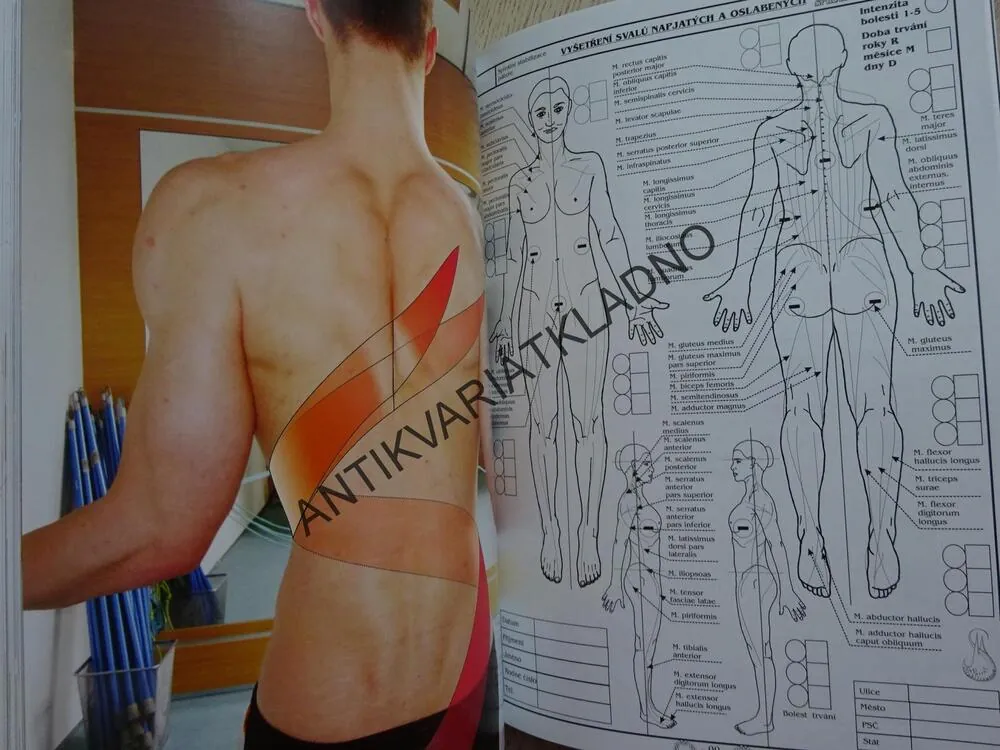 LÉČBA VÝHŘEZU MEZIOBRATLOVÉHO DISKU A SKOLIÓZY CVIČENÍM SPIRÁLNÍCH SVALOVÝCH ŘETĚZCŮ, **an