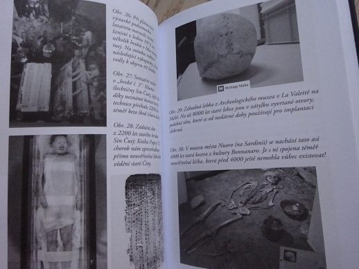 MEDICÍNA DOBY KAMENNÉ, HARTWIG HAUSDORF, **an