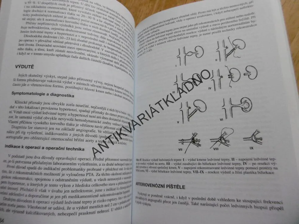 CÉVNÍ CHIRURGIE, FIRT, HEJNAL, VANĚK, UČEBNÍ TEXTY UNIVERSITY KARLOVY PRAHA