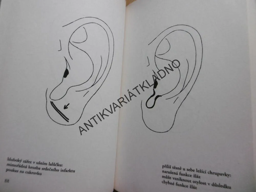 NEMOCI VYČTENÉ Z TVÁŘE, KURT TEPPERWEIN,