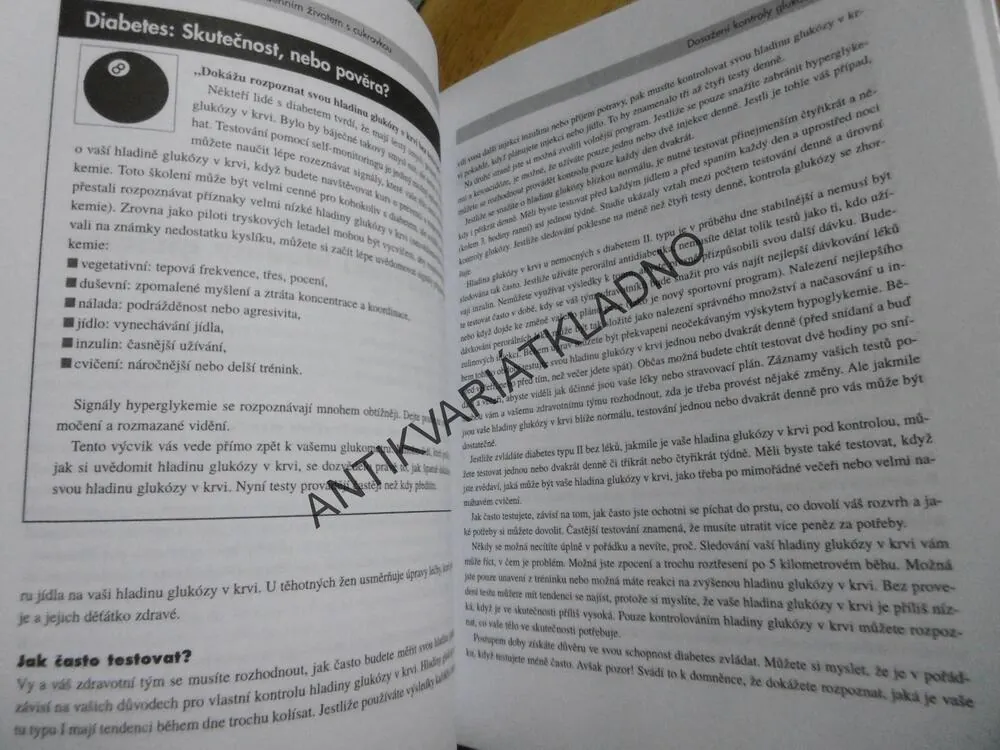 AMERICKÁ DIABETICKÁ ASOCIACE, KOMPLETNÍ PRŮVODCE KAŽDODENNÍM ŽIVOTEM S CUKROVKOU, **an