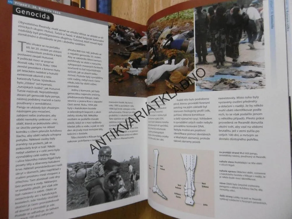 NĚMÝ SVĚDEK, VYUŽITÍ ANTROPOLOGIE PŘI ŘEŠENÍ KRIMINÁLNÍCH PŘÍPADŮ, ROXANA FERLLINI, **an