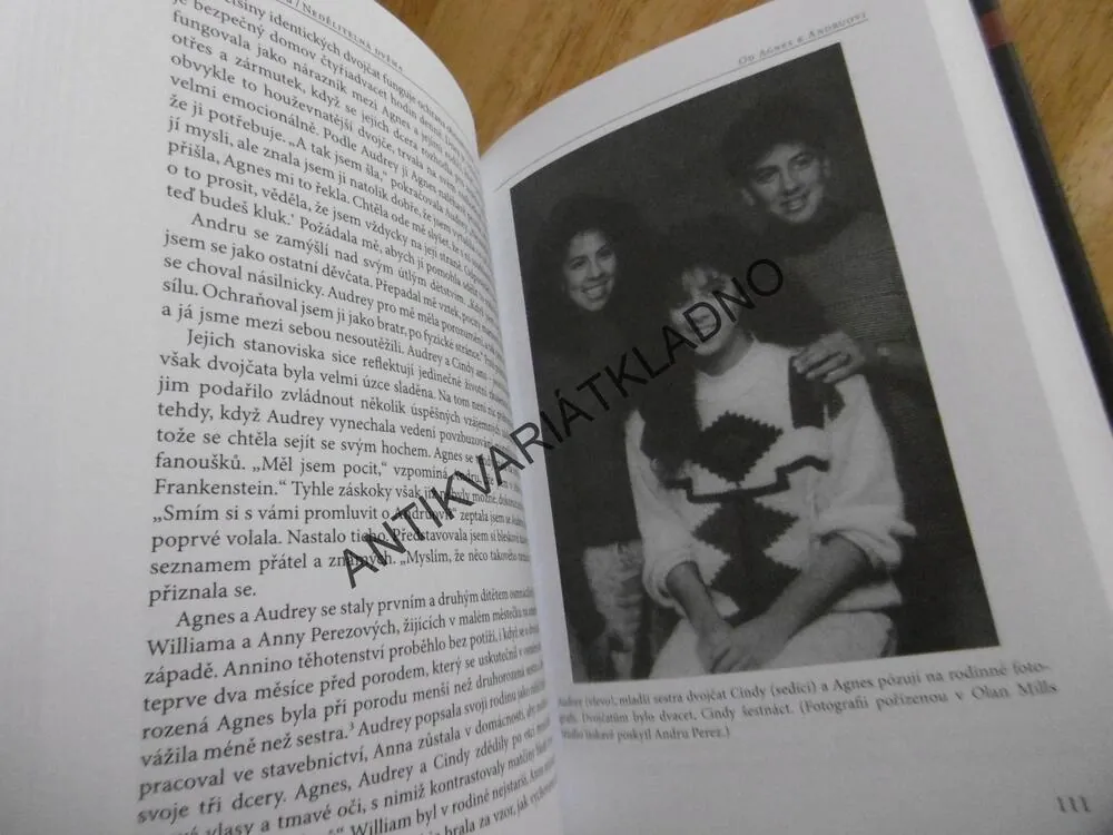 NEDĚLITELNÁ DVĚMA, ŽIVOTY VYJÍMEČNÝCH DVOJČAT, NANCY L. SEGALOVÁ, **an