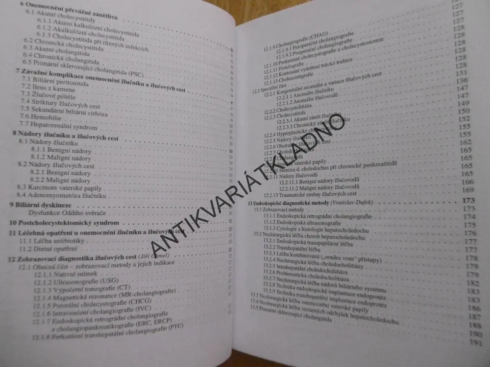 ONEMOCNĚNÍ ŽLUČNÍKU A ŽLUČOVÝCH CEST, MARIE BRODANOVÁ, **an
