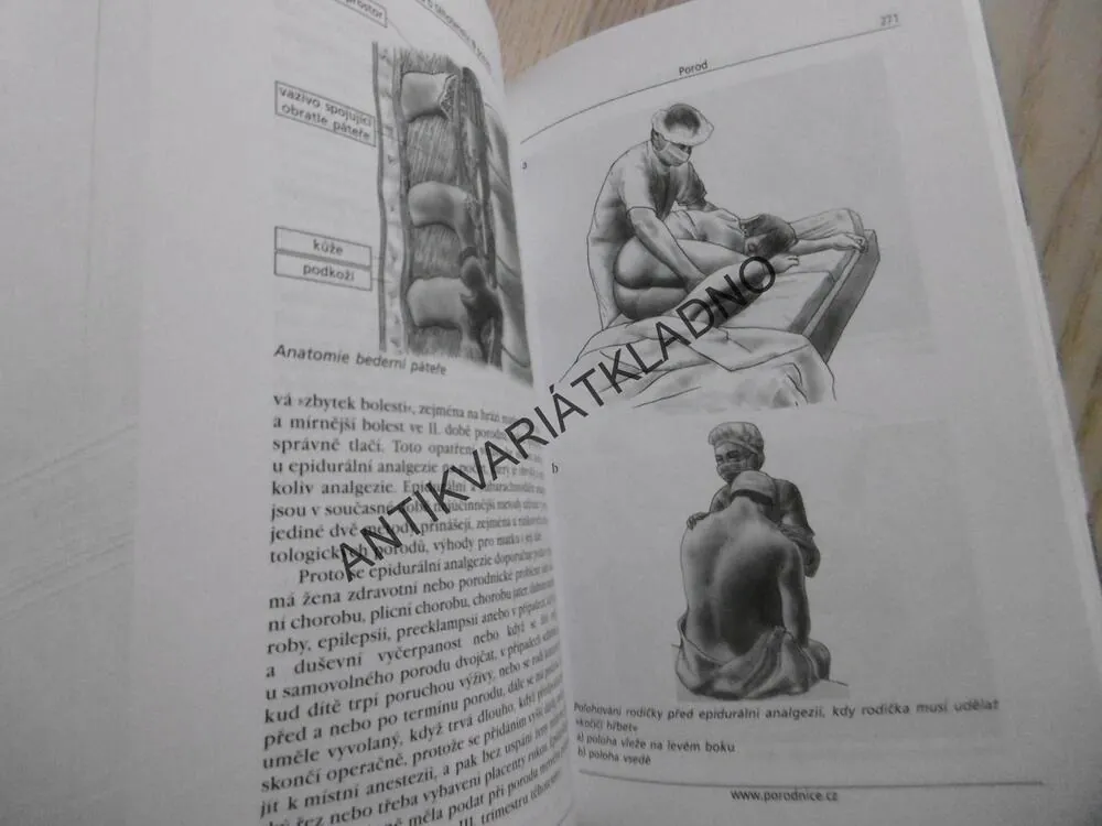 KNIHA O TĚHOTENSTVÍ A PORODU, ANTONÍN PAŘÍZEK,  **an