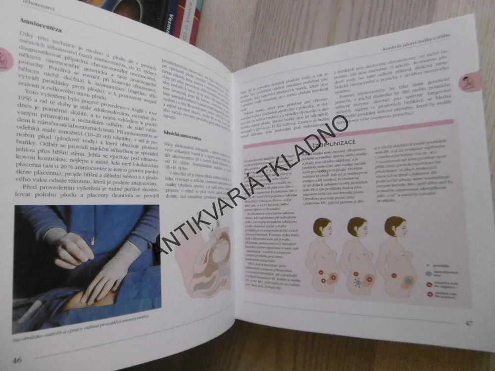 TĚHOTENSTVÍ A PÉČE O DÍTĚ, ILUSTROVANÝ ATLAS, OD POČETÍ DO VĚKU 6 LET, **an