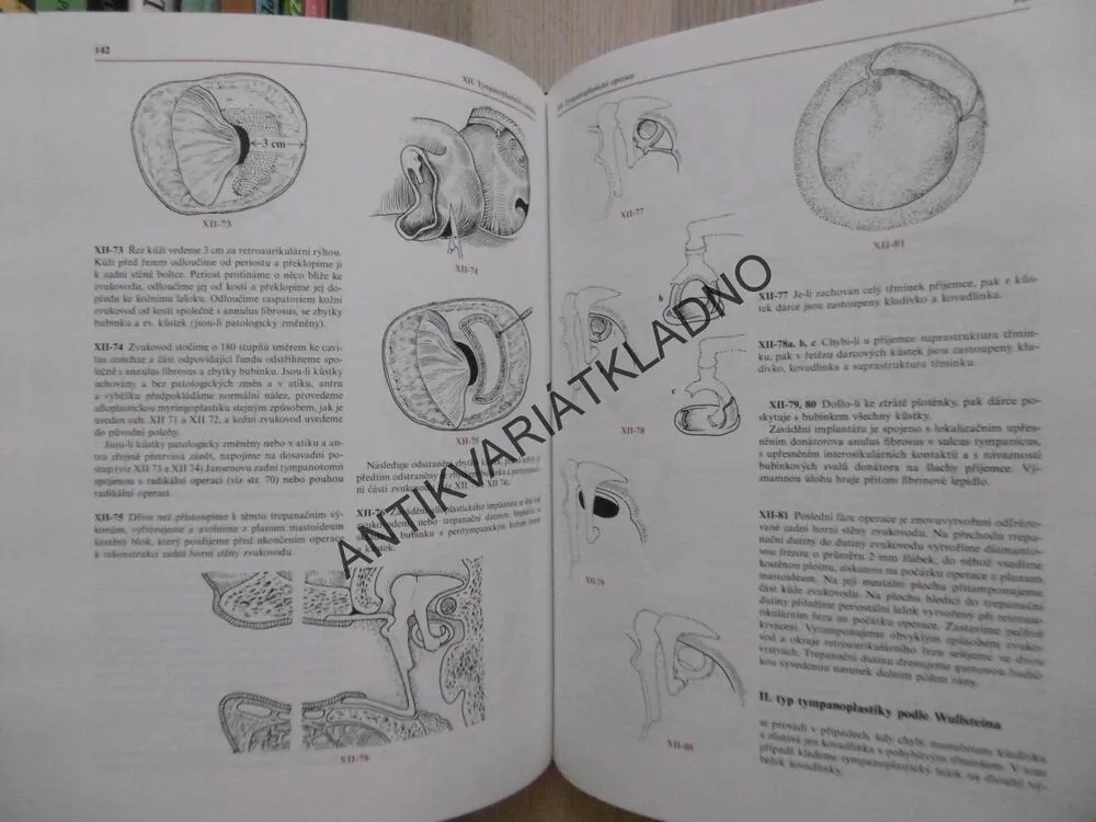 ATLAS CHIRURGIE UCHA, ERVÍN ČERNÝ, JAN BETKA