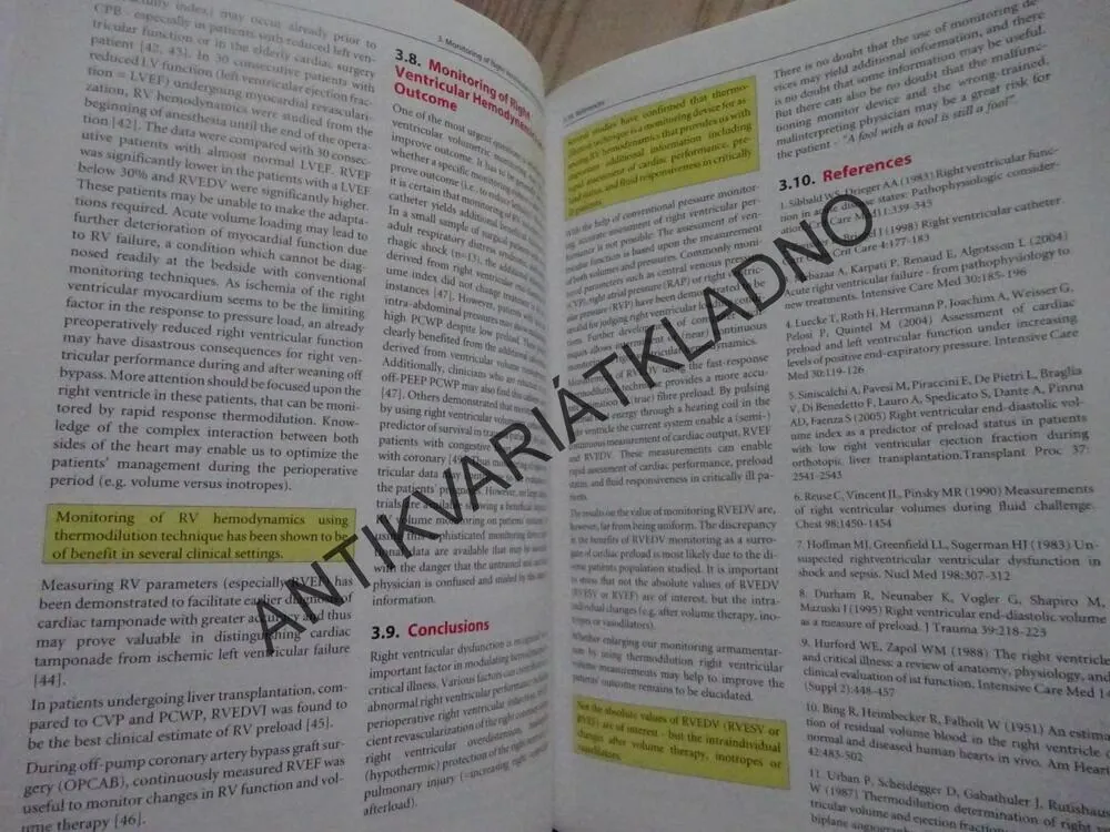 HEMODYNAMIC MONITORING, JOACHIM BOLDT, ANGLICKY, **an