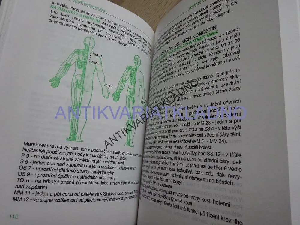 MANUPRESURA, AKUPUNKTURA BEZ JEHEL, RADOMÍR RŮŽIČKA, **an