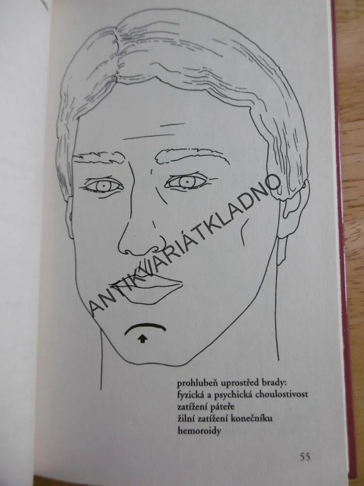 NEMOCI VYČTENÉ Z TVÁŘE, KURT TEPPERWEIN,
