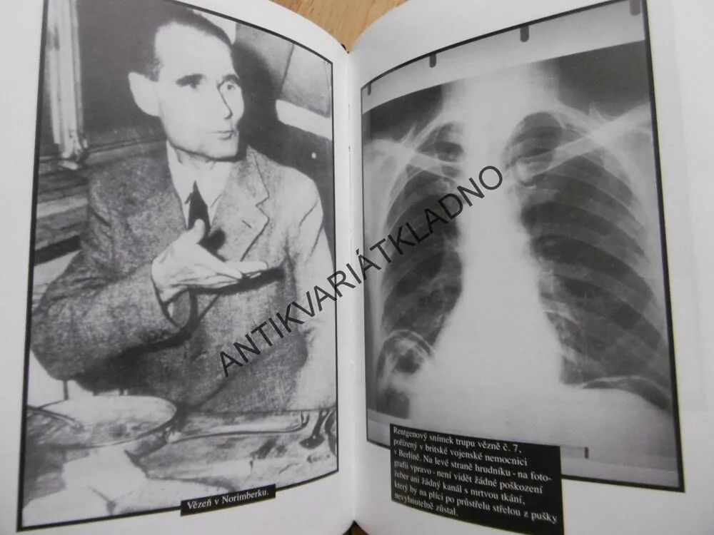 HESS, PODIVNÝ KONEC NEJSTARŠÍHO ŠPANDAVSKÉHO VĚZNĚ, HUGH THOMAS, **an