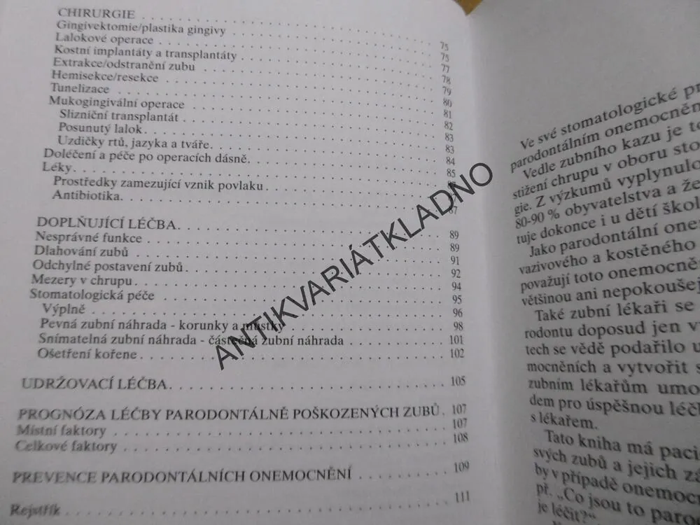 PARADONTOZU LZE LÉČIT, FRANZ STEINWANDTNER, **an