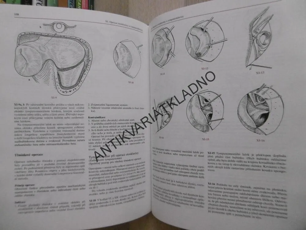 ATLAS CHIRURGIE UCHA, ERVÍN ČERNÝ, JAN BETKA